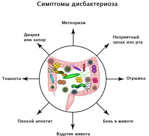 Лечение нарушения микрофлоры