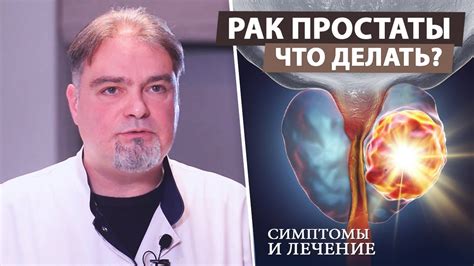 Лечение неопластического процесса предстательной железы