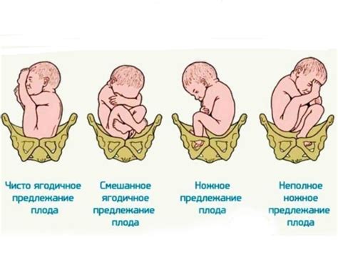 Лечение опущения яичек у мальчика