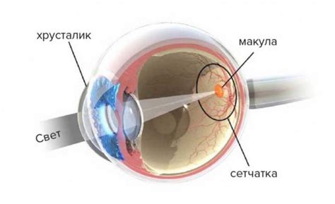 Лечение ослабления макулы рефлекса