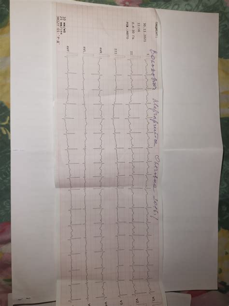 Лечение отклонения параметров QRS