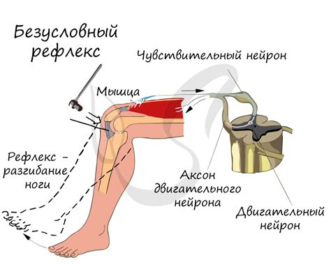 Лечение повышенных сухожильных рефлексов