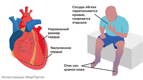 Лечение полной блокады сердца у взрослых