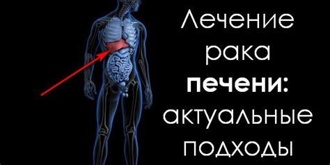 Лечение посажения печени: основные подходы и методы