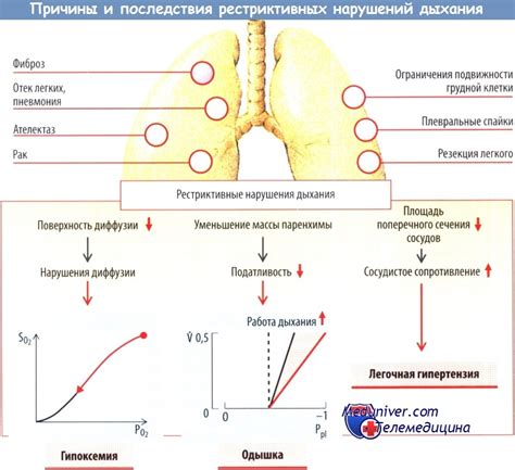 Лечение рестриктивных нарушений легких