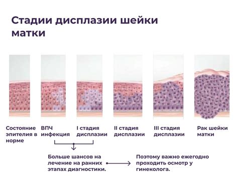 Лечение серой шейки