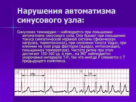 Лечение синусовой аритмии у взрослых