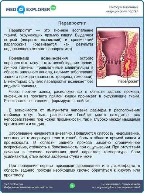 Лечение тромбированного наружного геморроя