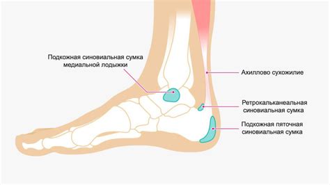 Лечение утолщения синовиальной оболочки голеностопного сустава