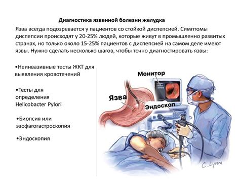 Лечение язвы