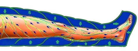 Лимфодренаж: что это и как он работает
