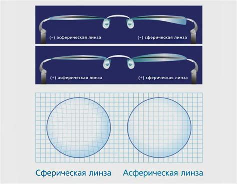 Линзы в медицине: лечение глазных заболеваний