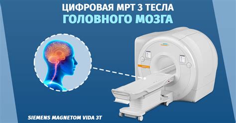 Магнитно-резонансная томография головного мозга: подробности процедуры