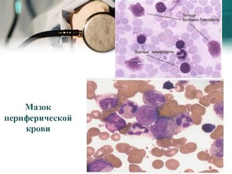 Мазок периферической крови: основные цели и задачи