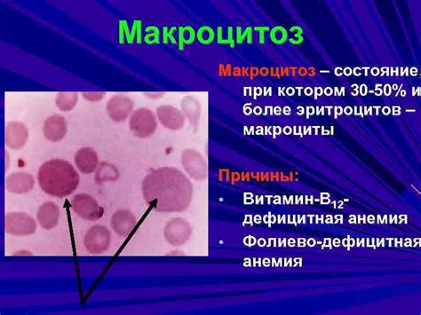 Макроциты ниже нормы: причины и Комаровский