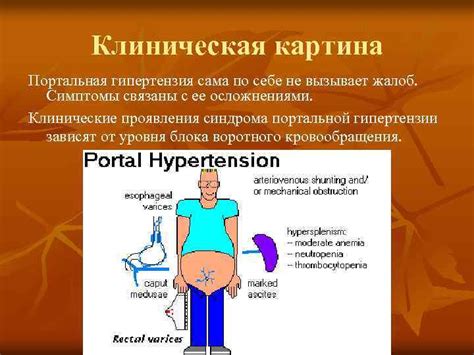 Махровая гипертония и ее определение