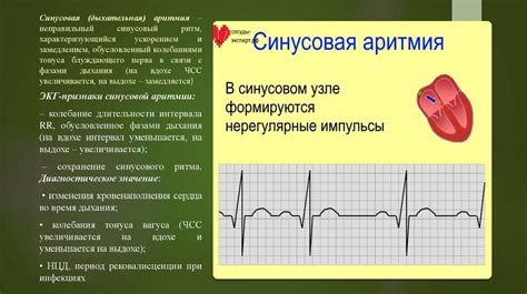 Медикаментозные причины синусовой брадикардии