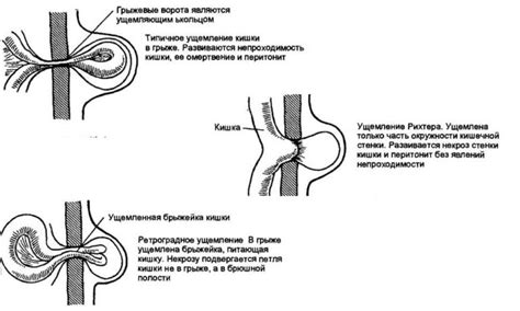 Медицинские аспекты пупочного кольца