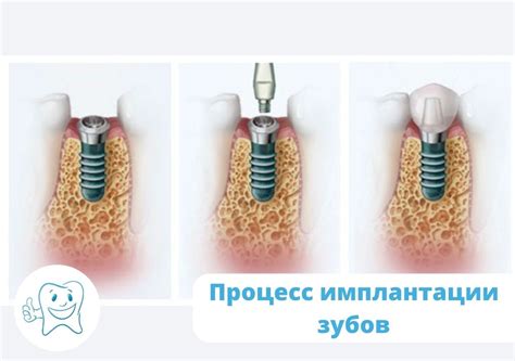 Медицинское объяснение снов о поражении зубов кариесом