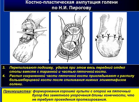 Медицинское разъяснение: ампутация конечности в собственном сне