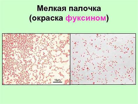 Мелкая палочка: секрет анализов