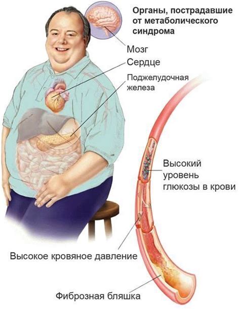 Метаболический синдром и холодные ступни