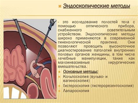 Методы выскабливания в гинекологии