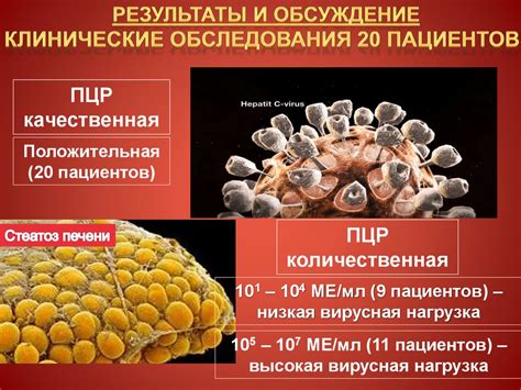 Методы диагностики гепатита