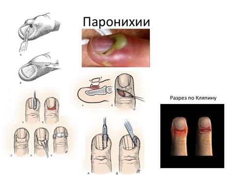 Методы диагностики гнойных язв