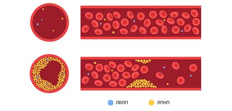 Методы диагностики и измерения уровня холестерина ЛПНП у мужчин