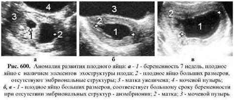 Методы диагностики некачественного эмбриона