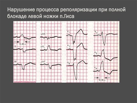 Методы диагностики неспецифических изменений процессов реполяризации