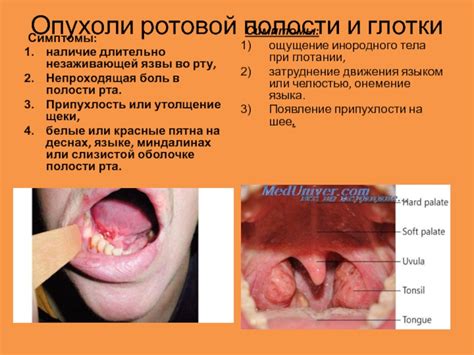 Методы диагностики опухоли во рту