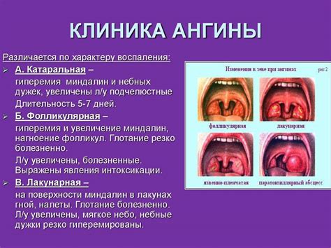 Методы диагностики хронического декомпенсированного тонзиллита