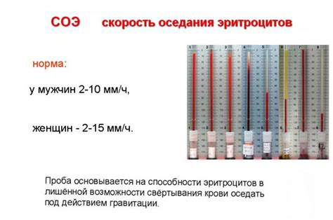 Методы измерения и контроля СОЭ 106