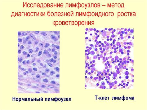 Методы исследования метаболической активности лимфоузлов