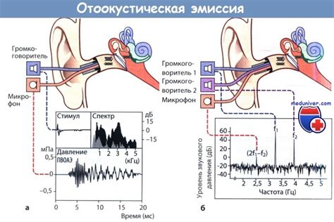 Методы исследования отоакустической эмиссии