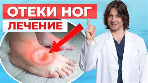 Методы лечения атрофии ноги