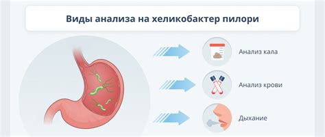 Методы лечения желудочных расстройств