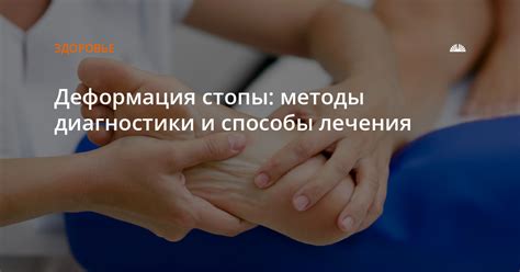 Методы лечения колита стопы