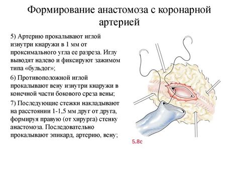 Методы лечения кошницы