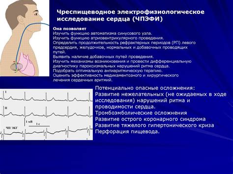 Методы лечения нестабильного синусового ритма сердца