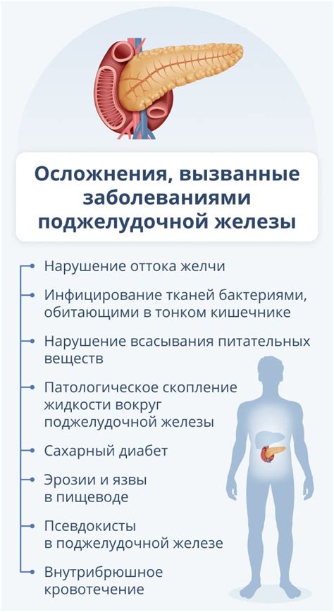 Методы лечения новообразования поджелудочной железы