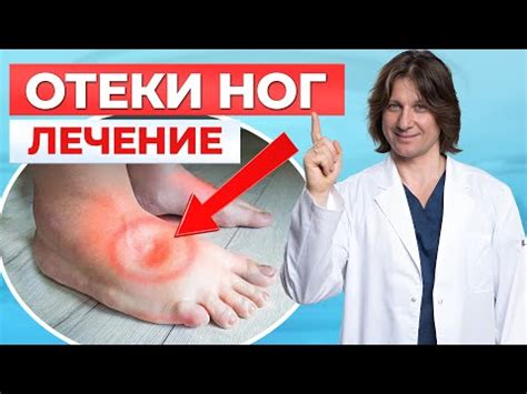 Методы лечения отека пальцев ног