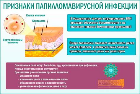 Методы лечения папилломавируса у женщин