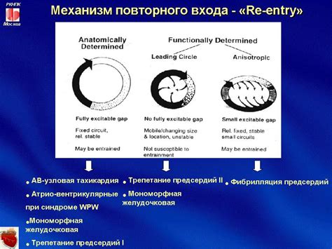 Методы лечения пароксизмальных нарушений ритма