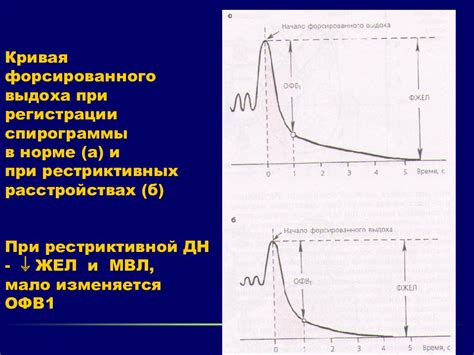 Методы лечения повышенной спирограммы жел