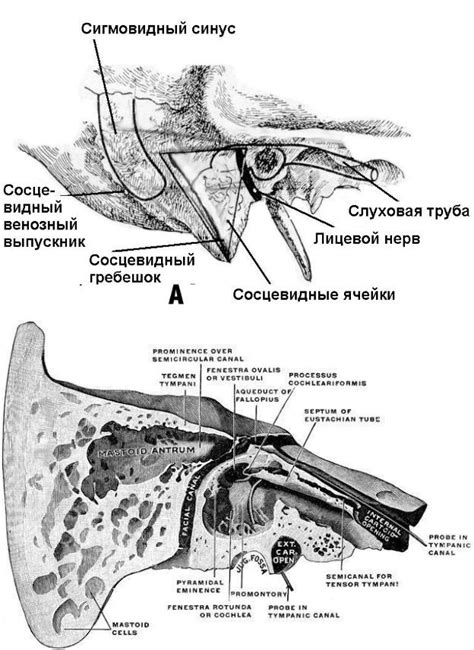 Методы лечения склеротического типа сосцевидного отростка