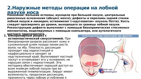 Методы лечения снижения прозрачности лобной пазухи