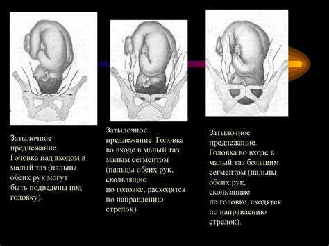 Методы определения акушерского срока недели